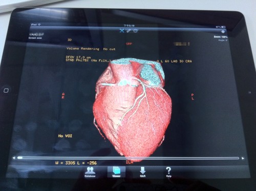 iPad_heart